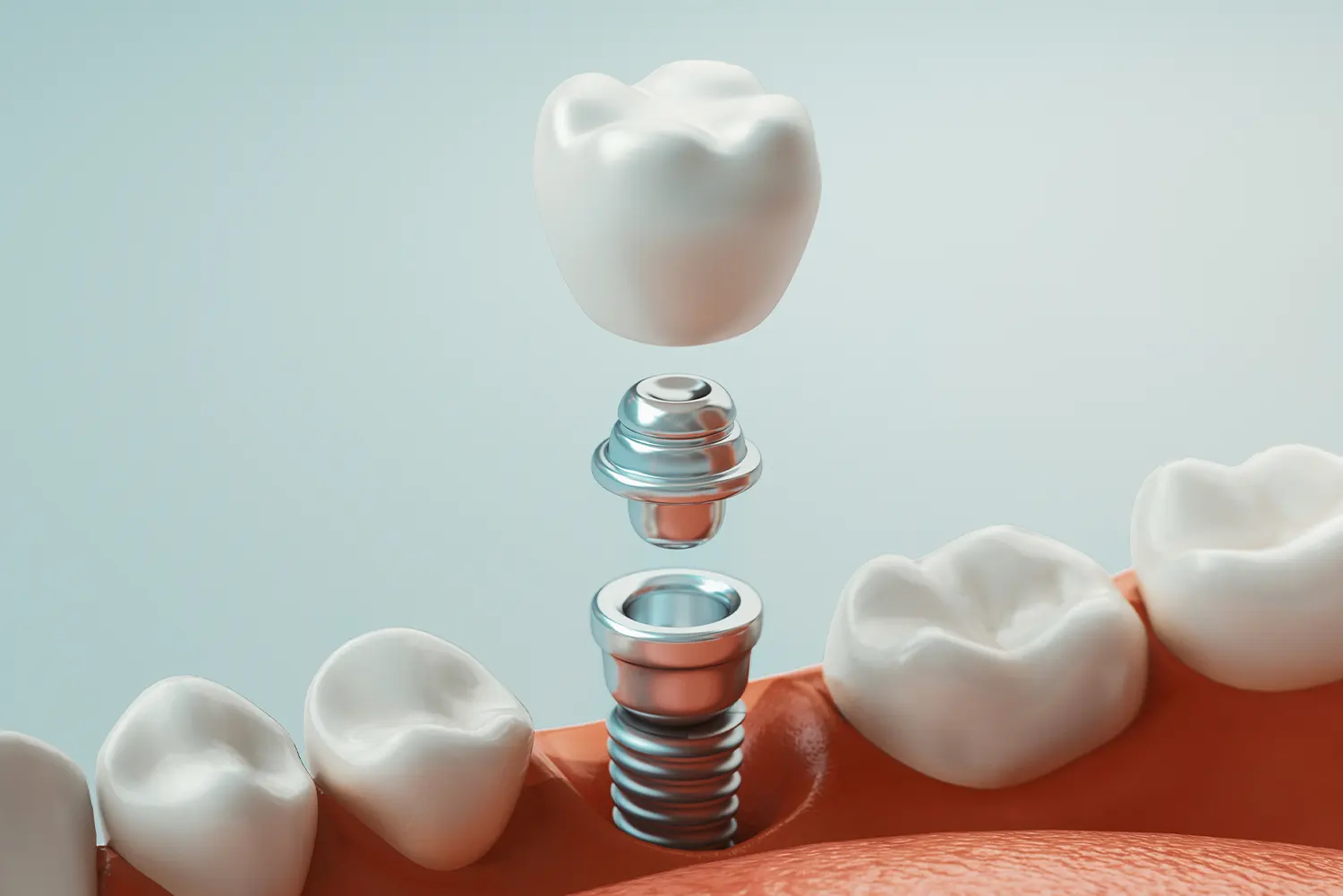 Dentist Near Me