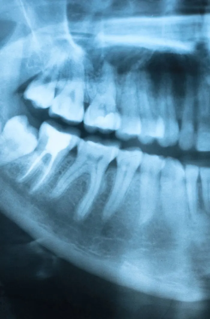 Dentist in Methuen