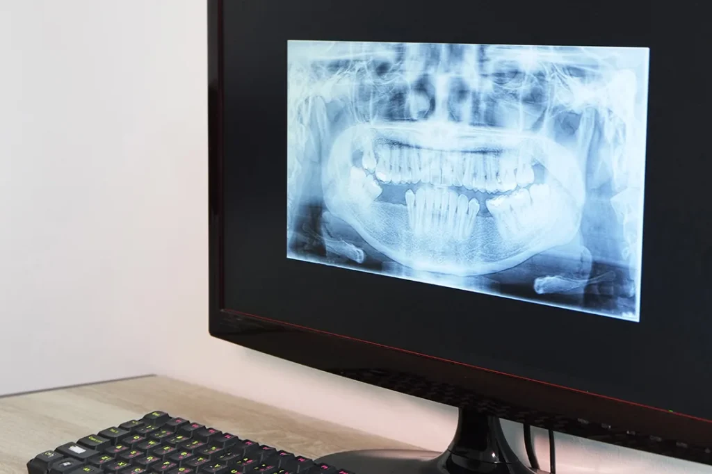 Methuen MA Dentist