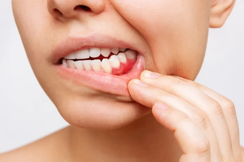 Dentist in Methuen MA