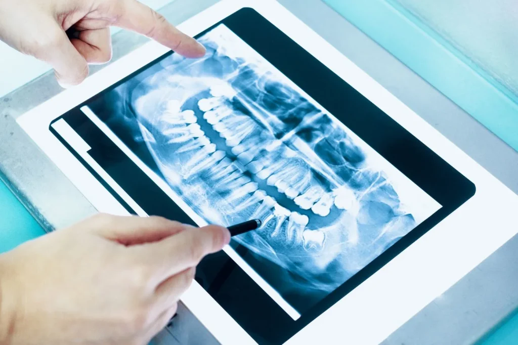 Dentist Methuen