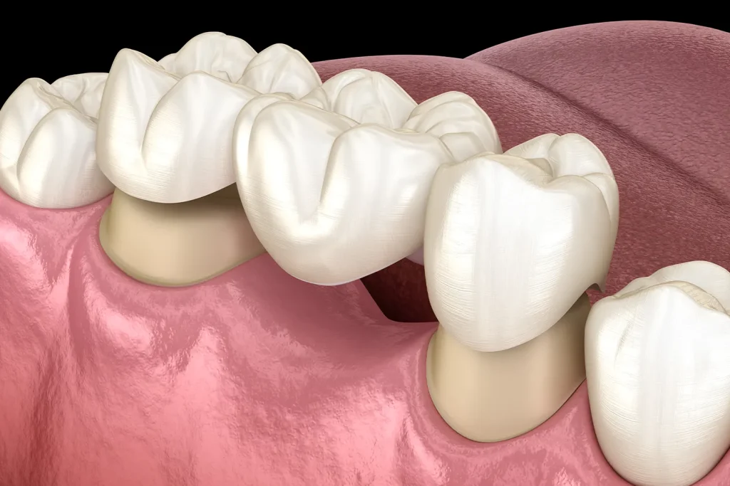 Methuen MA Dentist