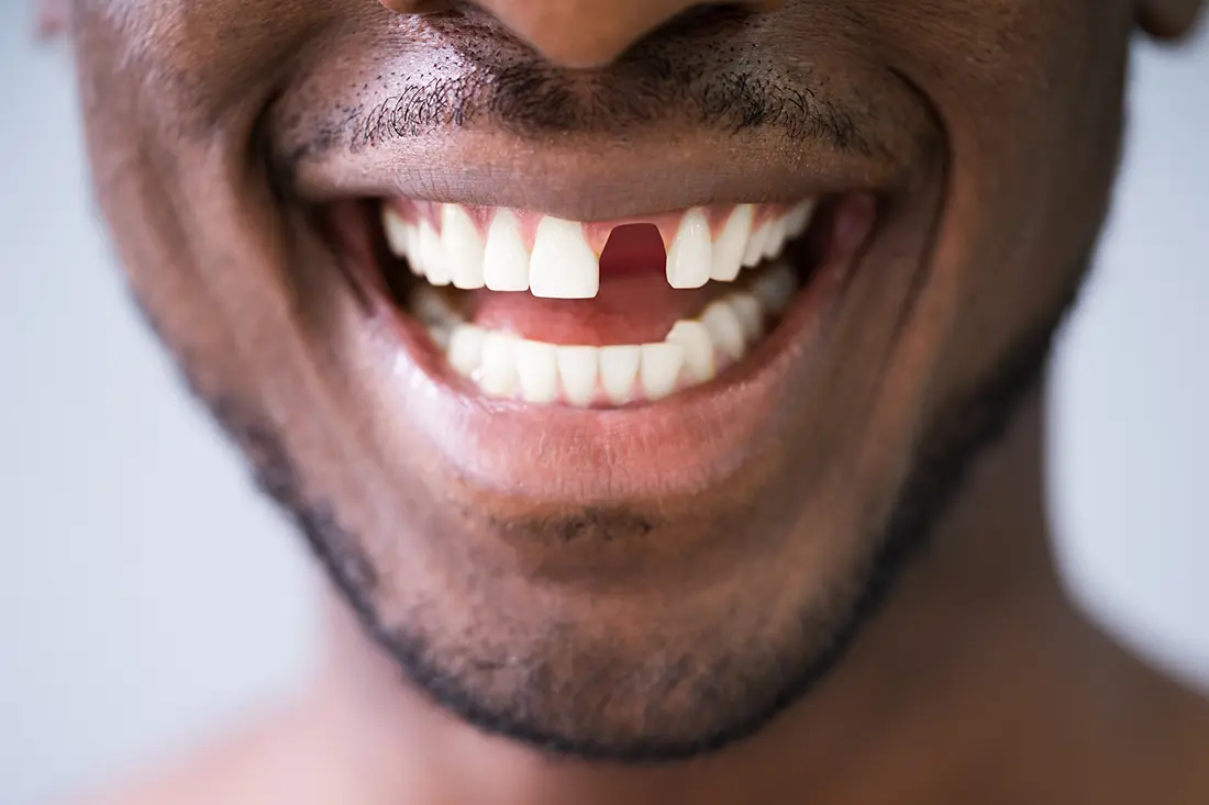 Methuen Dentist