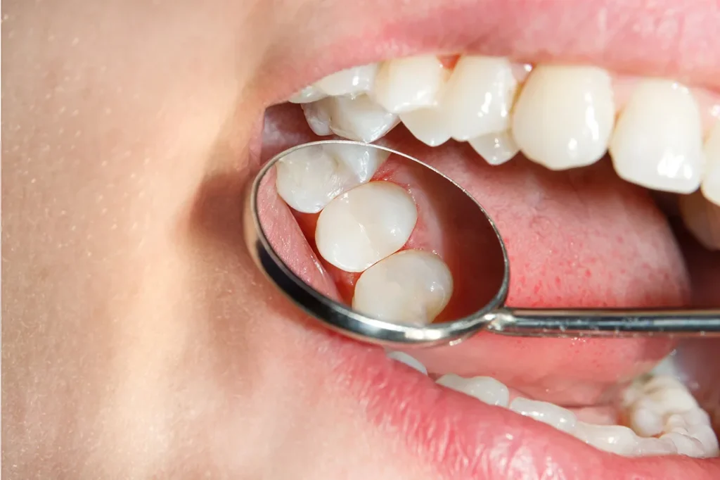 Dentist Near Me