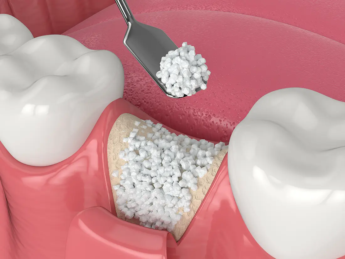 Dentist Methuen