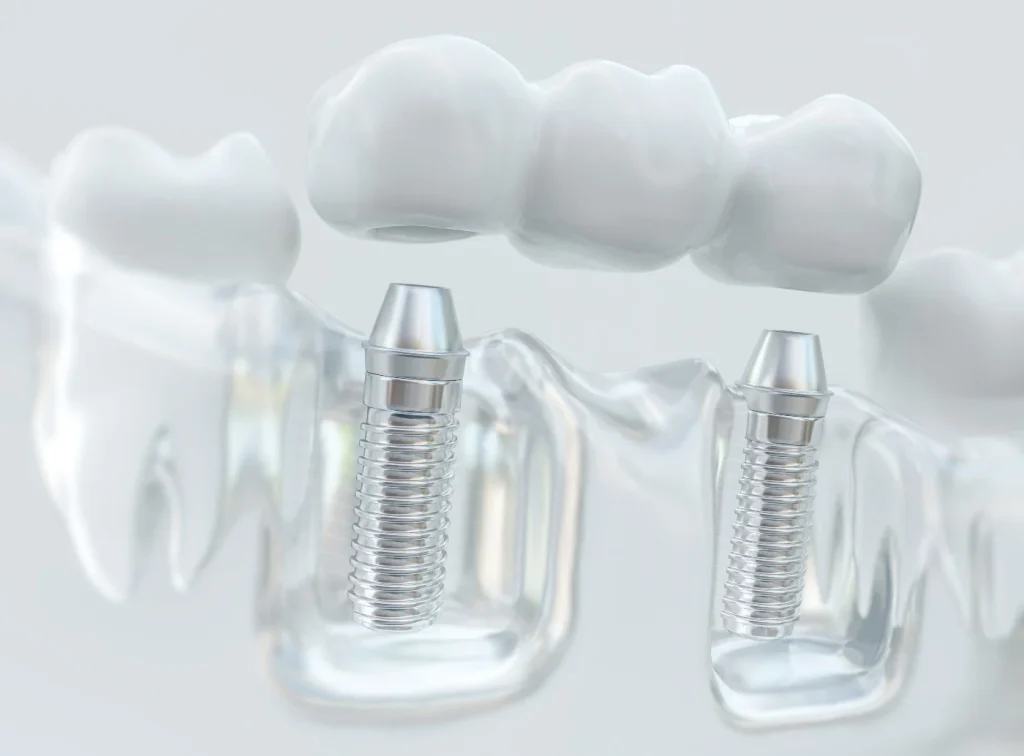 Dentist Near Me