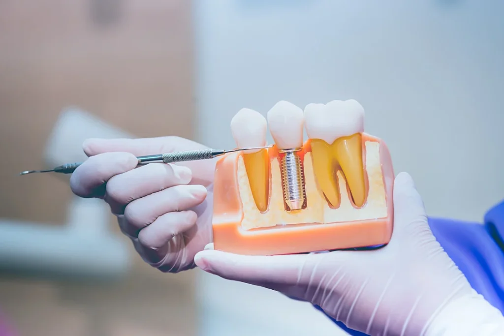 Dentist in Methuen MA